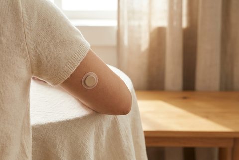 Glucose-sensor op de bovenarm met telefoon ernaast die de waarde toont